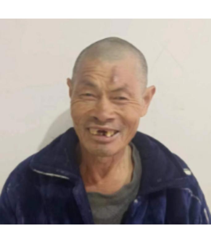 走失者照片 帮他回家：信阳六旬老人被救助，门牙...