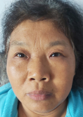 走失者照片 邢台寻亲：五旬女子被救助，穿蓝色上...