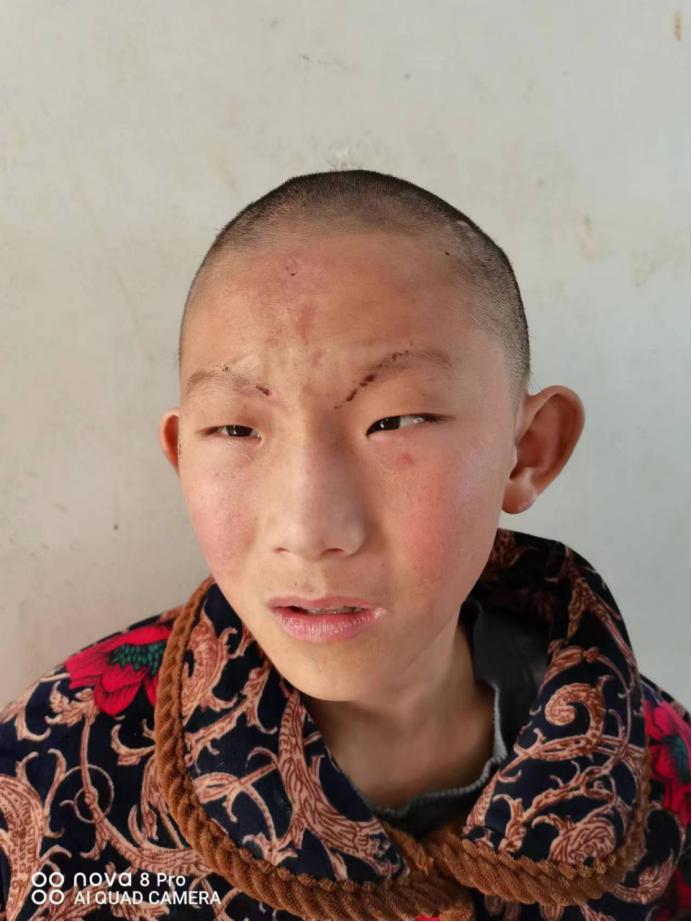 走失者照片 谁家孩子走丢了？15岁男孩在驻马店...