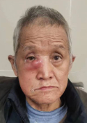 走失者照片 桂林寻亲：七旬老人被救助，自述叫王...