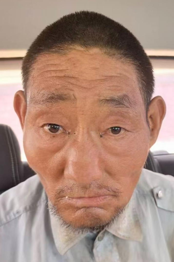 走失者照片 全国救助站