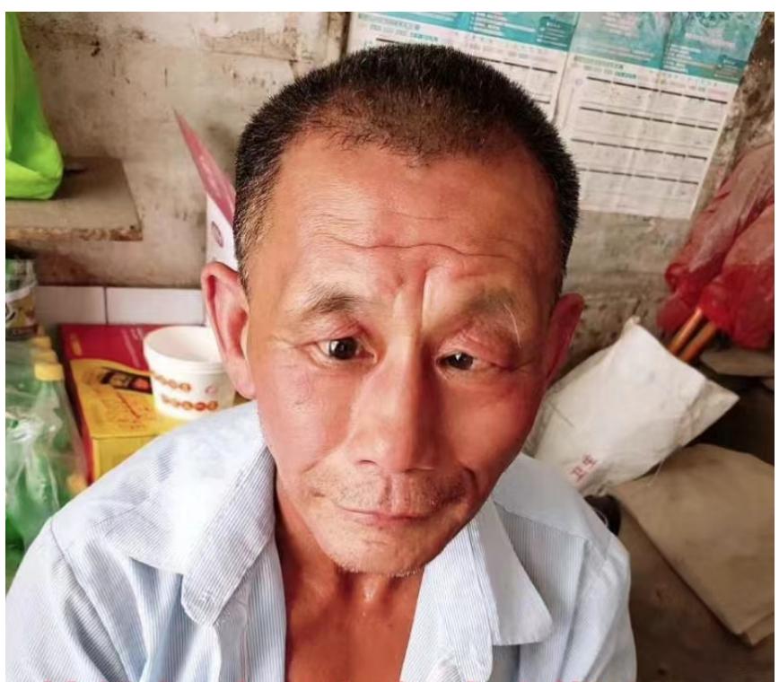 走失者照片 南充急寻：六旬老人走失，穿蓝色中山...