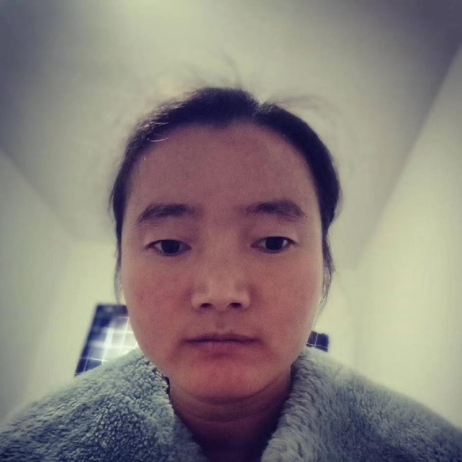 走失者照片 亳州急寻：青年女子走失，患精神障碍...