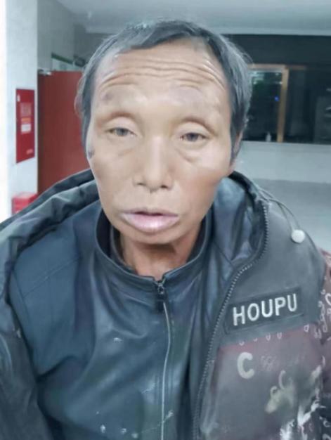 走失者照片 凉山西昌寻亲：中年男子被救助，无法...