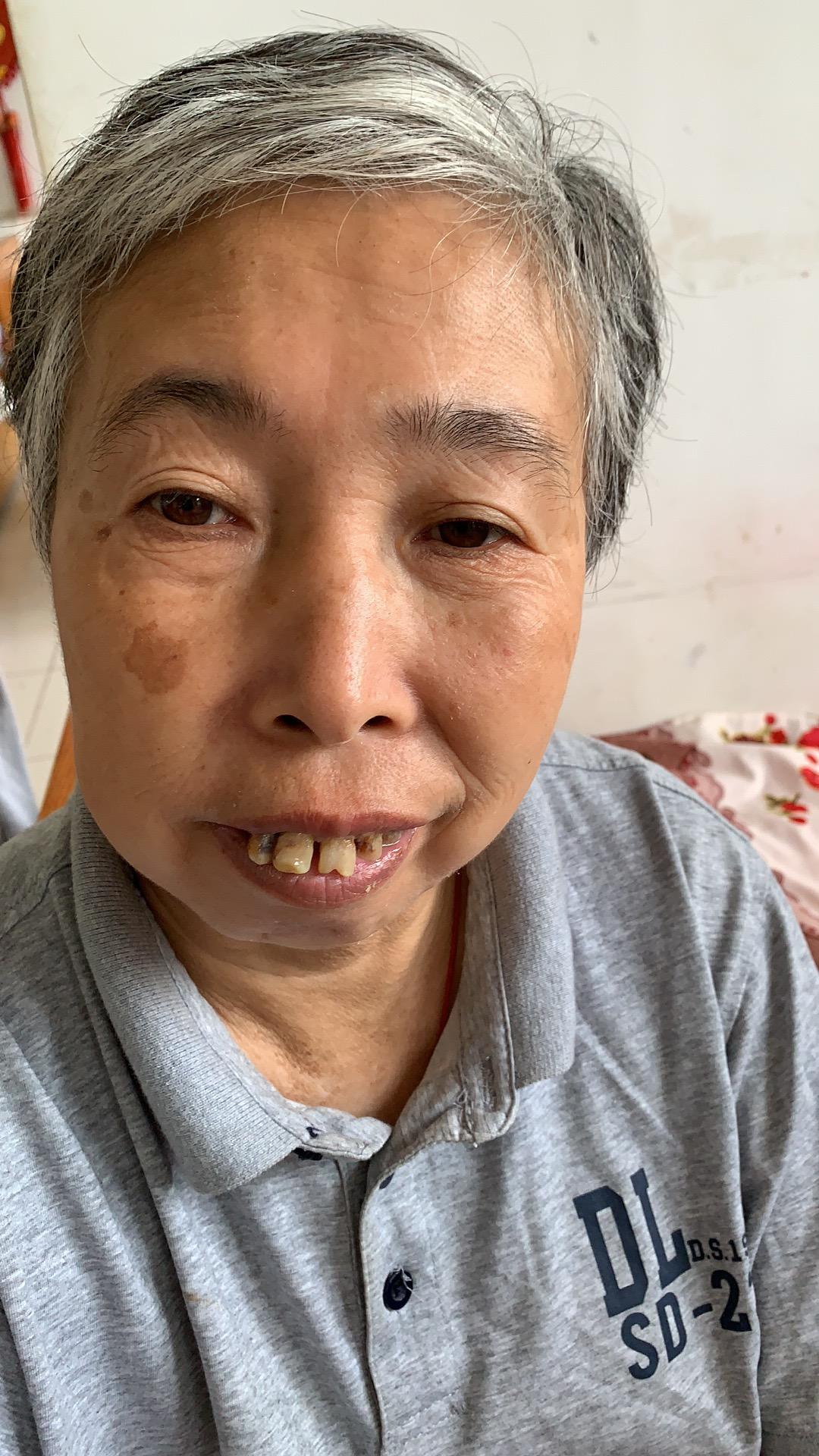 走失者照片 急寻亲友：烟台六旬老太被救助数年，...