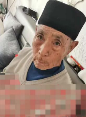 走失者照片 临沂市寻人：八旬老人走失，患阿尔茨...