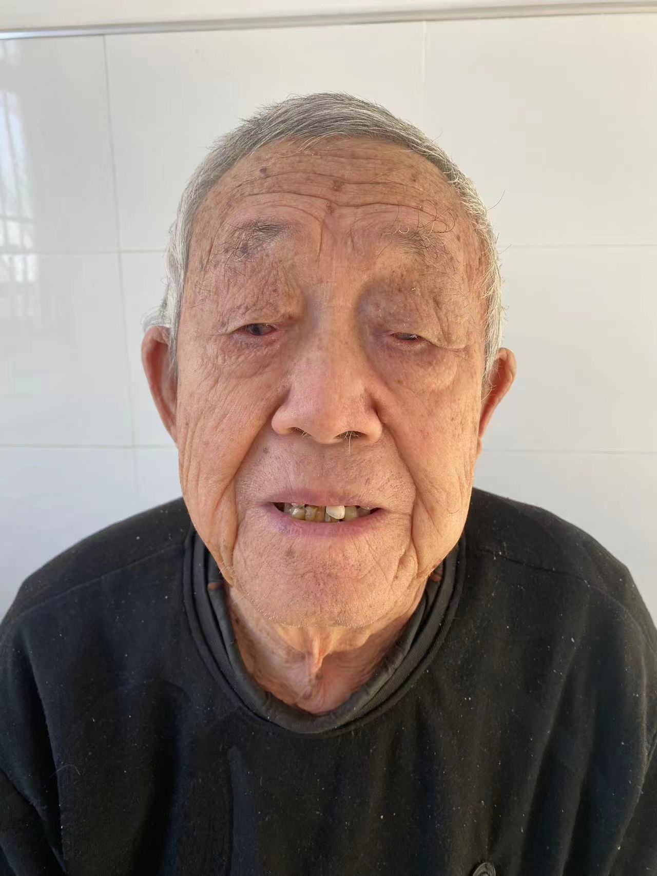 走失者照片 唐山寻亲：七旬老人被救助，自述叫张...