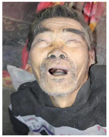 走失者照片 定西寻亲：七旬老人在出租屋去世，疑...