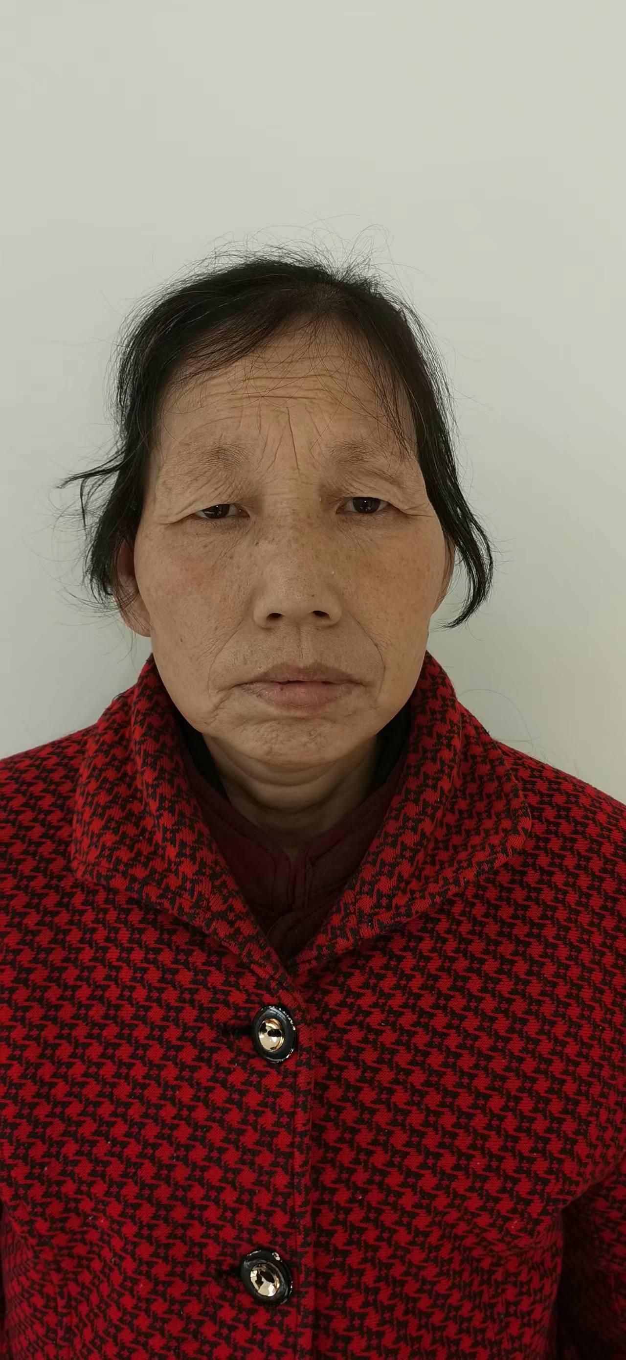 走失者照片 商洛寻亲：五旬女子被救助，自述叫李...