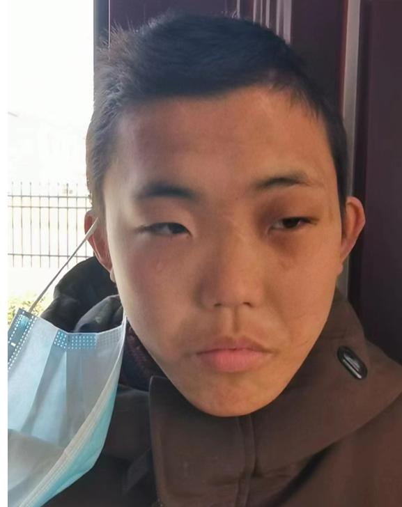走失者照片 商丘市永城市寻亲：16岁男孩被救助...
