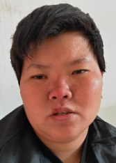 走失者照片 玉林寻亲：青年女子被救助，高1米5...
