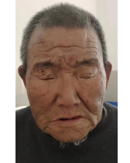 走失者照片 随州寻亲：六旬老人被救助，穿黑色外...