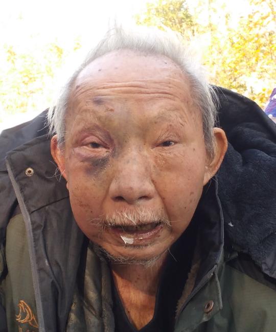 走失者照片 衡阳寻亲：七旬老人被救助，穿黑色冲...