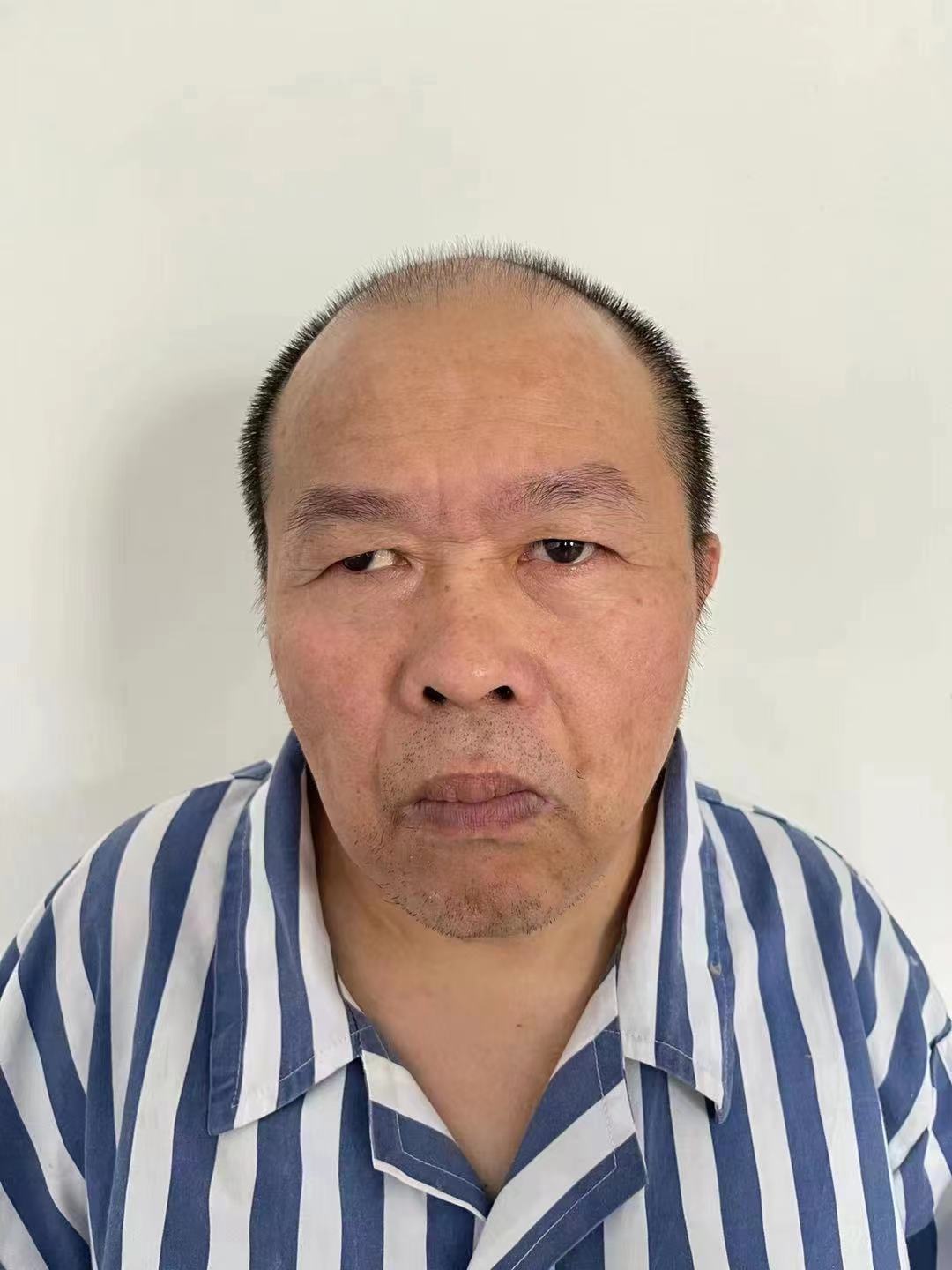 走失者照片 北京寻亲：中年男子被救助多年，名叫...