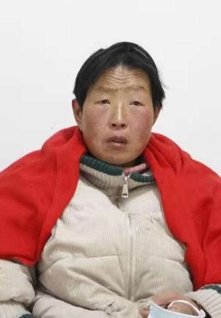 走失者照片 枣庄寻亲：五旬女子被救助，高1米6...