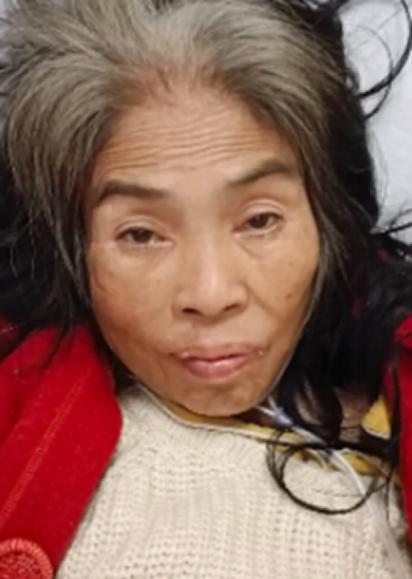 走失者照片 北海寻亲：五旬女子被救助，自述叫阮...