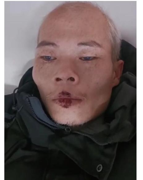 走失者照片 海口寻亲：五旬男子被送医，不会说话