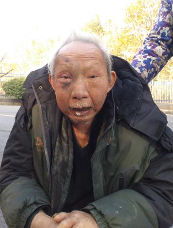 走失者照片 衡阳寻亲：七旬老人被救助，穿黑色冲...