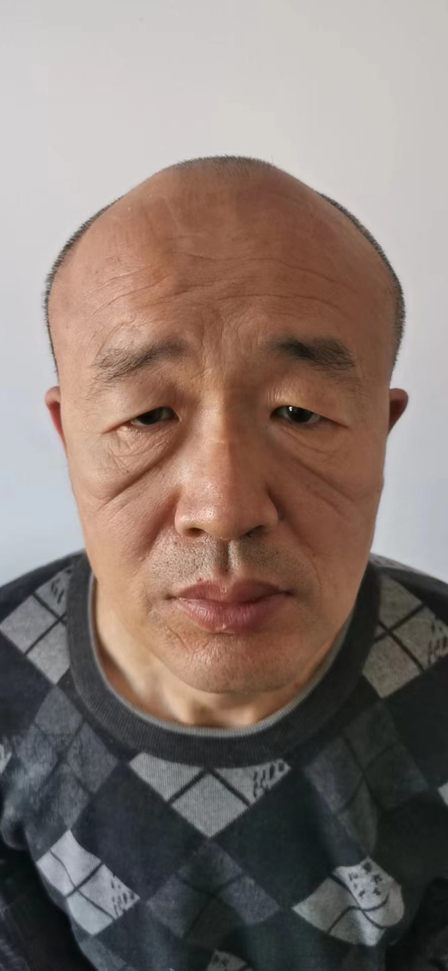 走失者照片 沈阳寻亲：五旬男子被救助，疑似精神...