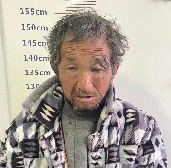 走失者照片 亳州寻亲：六旬老人被救助，穿棉睡衣...