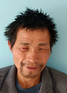 走失者照片 急寻亲友：阜阳五旬男子被救助，偏瘦...