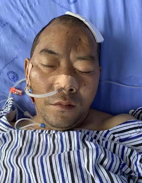 走失者照片 广安寻亲：中年男子因遭遇车祸被救助...