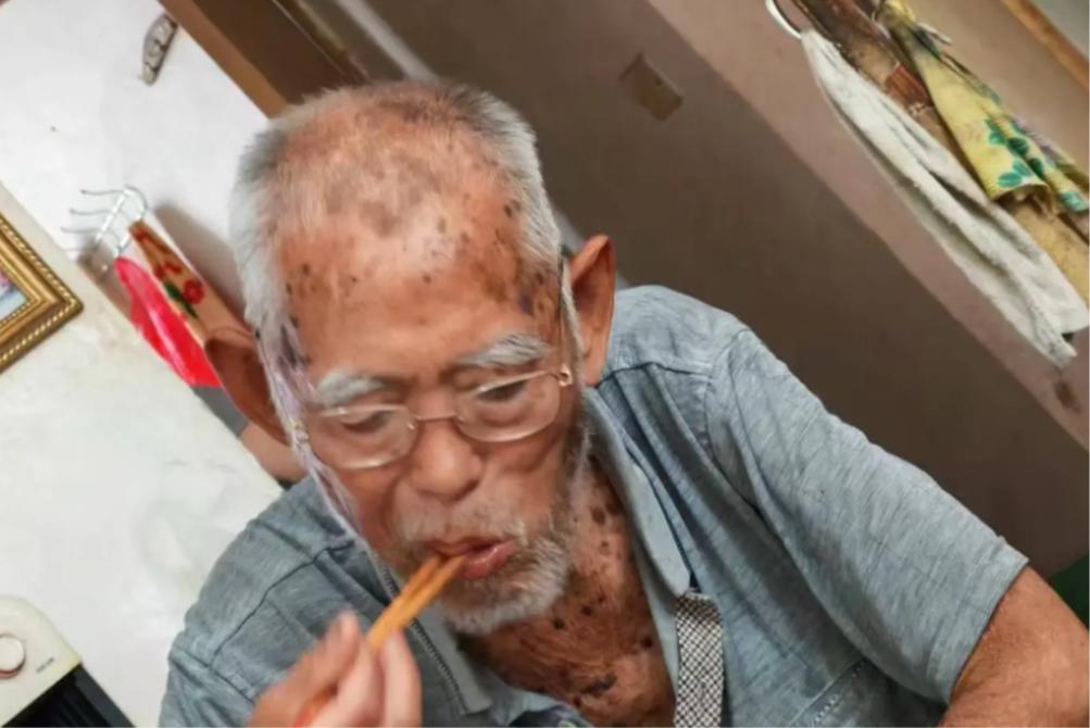 走失者照片 临沂寻人：八旬老人走失，患小脑萎缩...