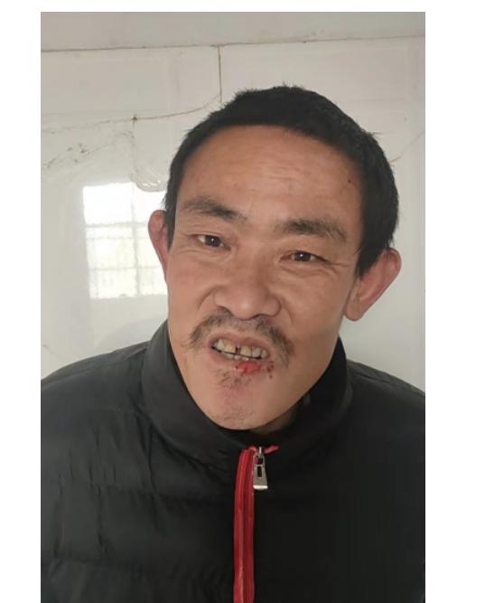 走失者照片 周口寻亲：五旬男子被救助，穿黑色棉...