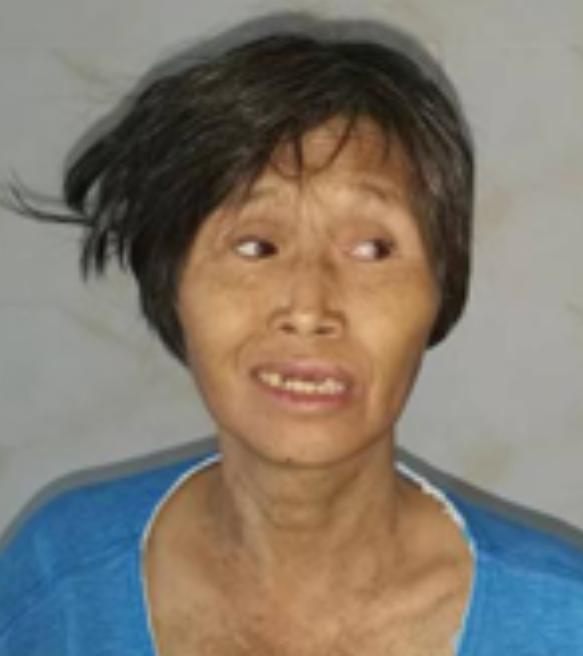 走失者照片 钦州寻亲：五旬女子被救助，穿蓝黑色...