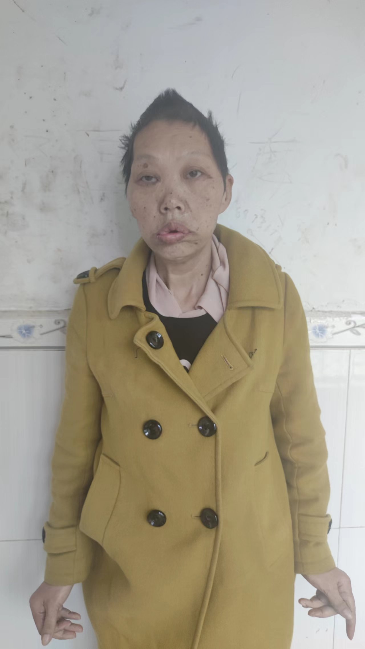 走失者照片 衡阳耒阳寻亲：五旬女子被救助，穿黄...