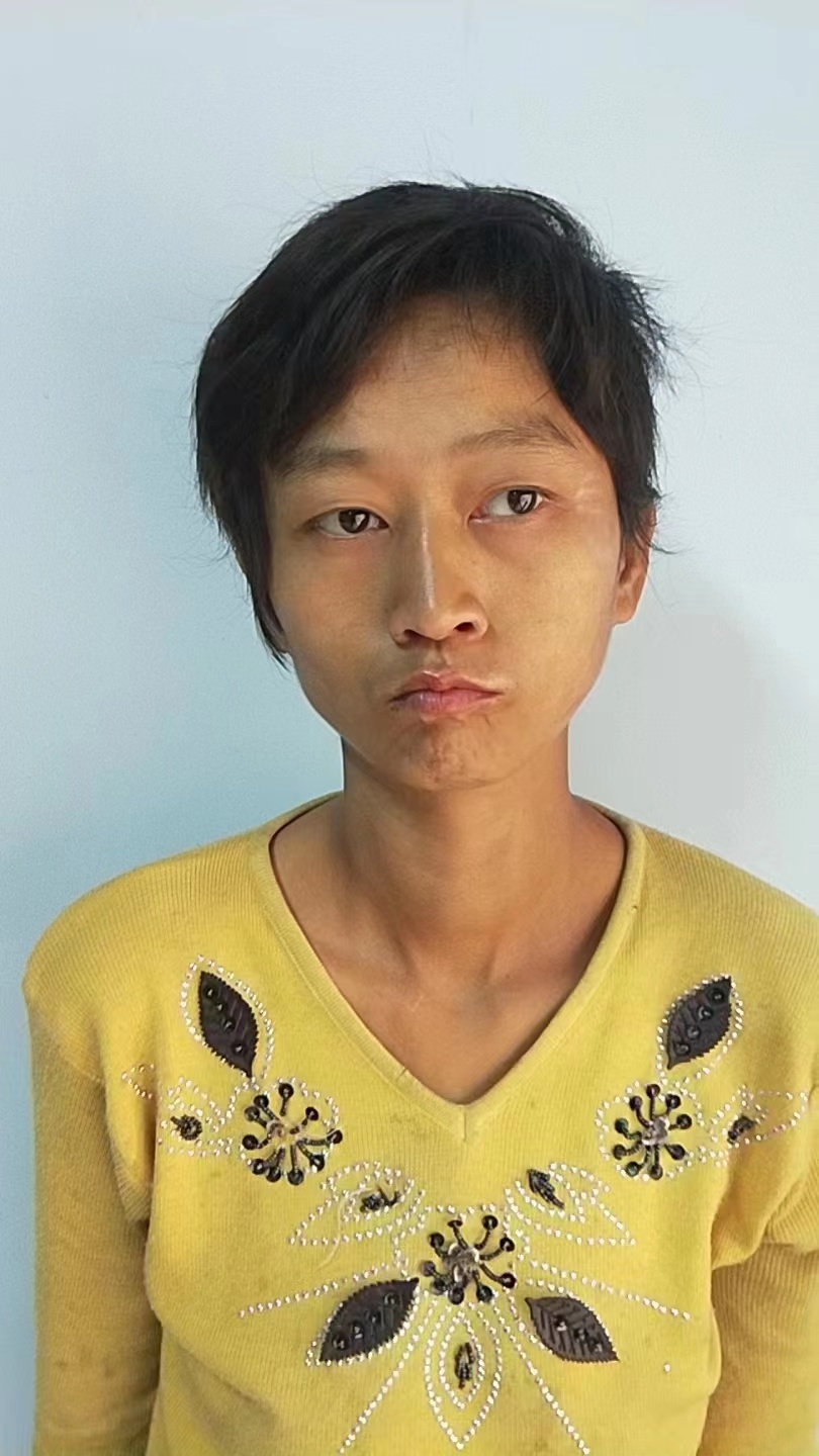 走失者照片 邯郸寻亲：青年女子被救助，短发，穿...