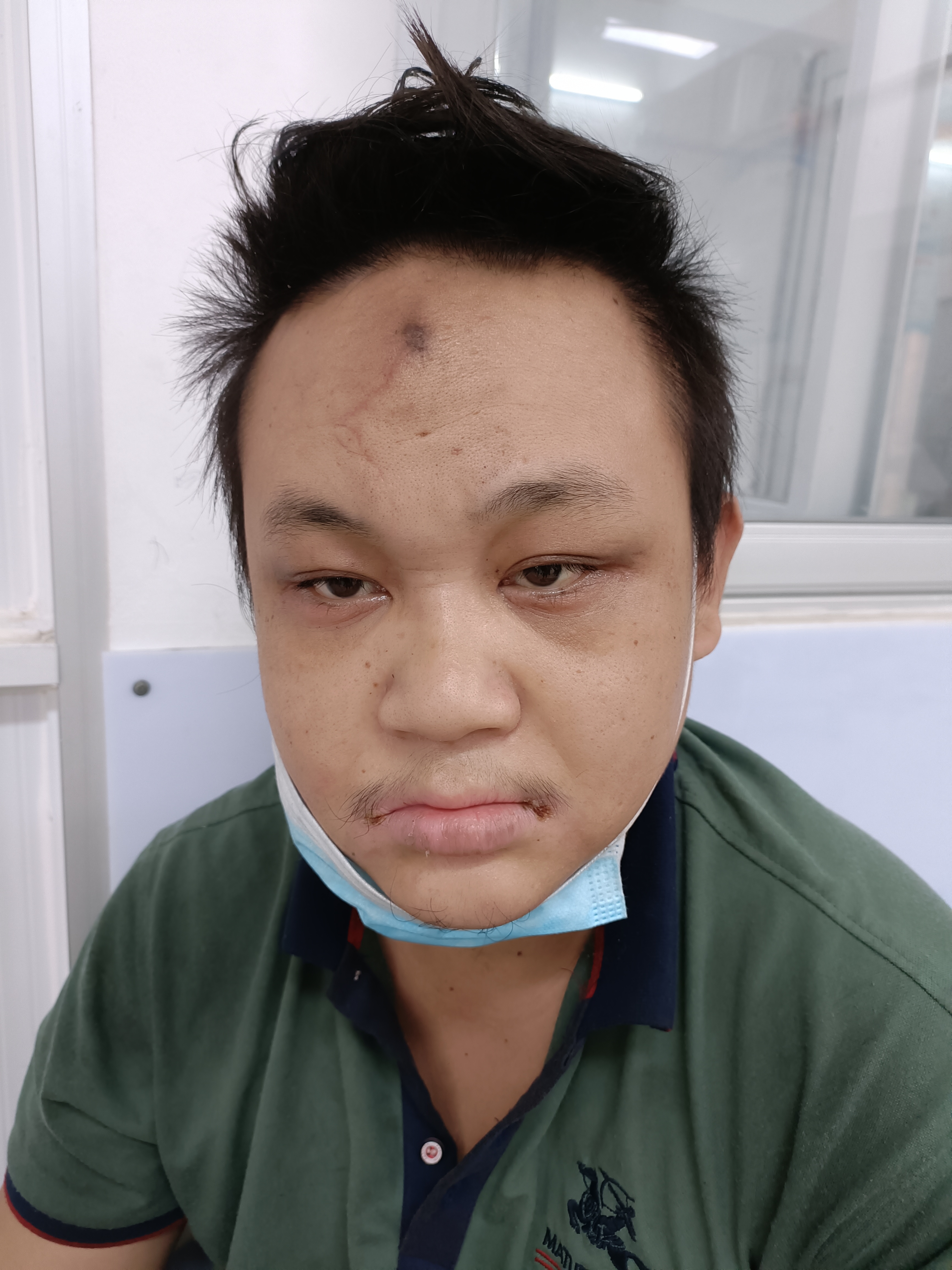 走失者照片 海口寻亲：青年男子被救助，自述叫李...