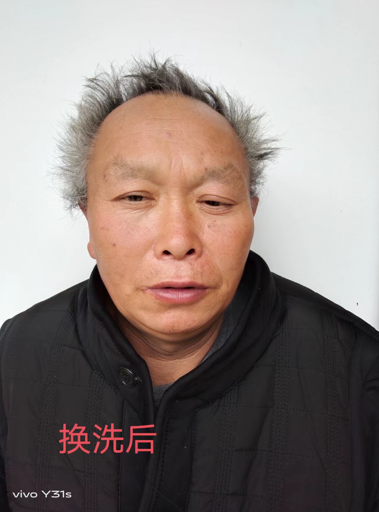 走失者照片 亳州寻亲：五旬男子被救助，自述叫李...