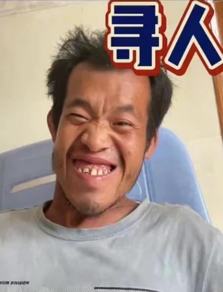走失者照片 湛江急寻：青年男子走失数十日，智力...