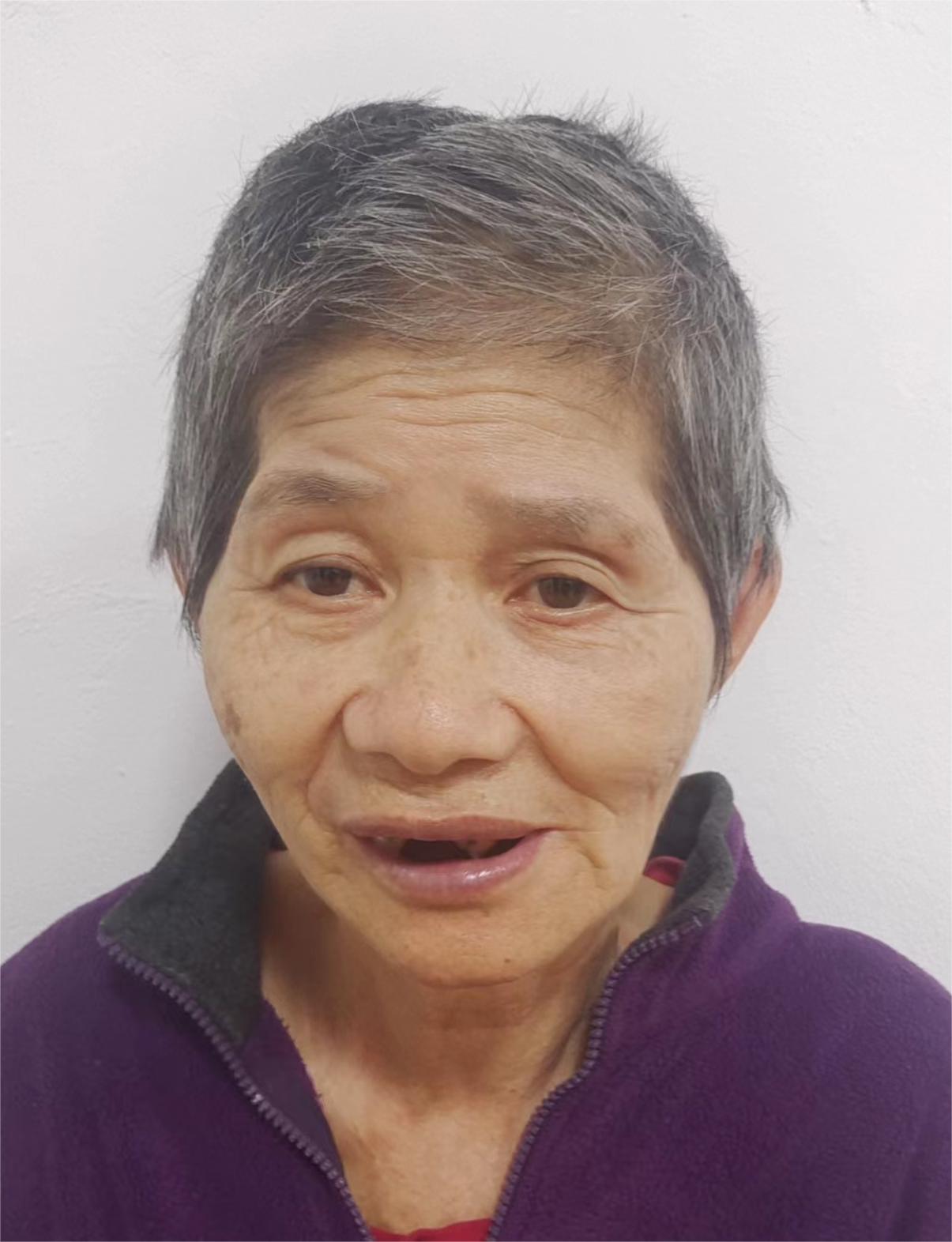 走失者照片 汕尾寻亲：陆丰六旬老太被救助数年，...