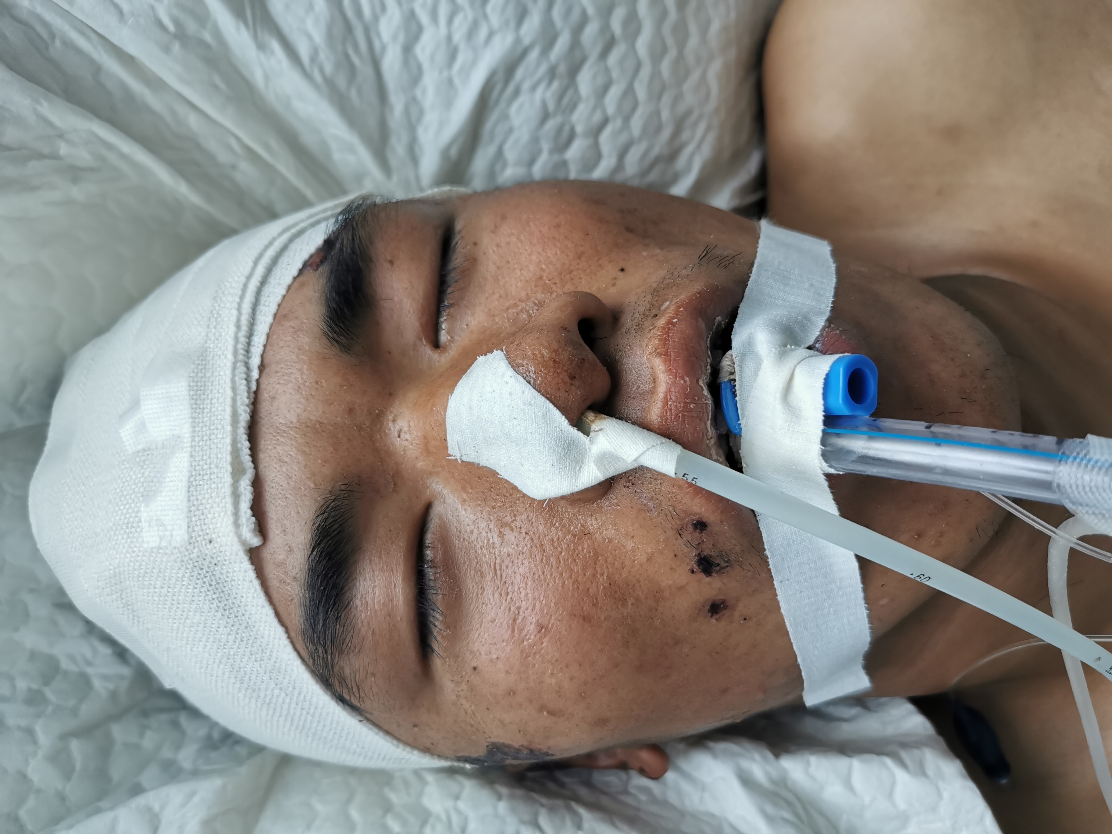 走失者照片 紧急寻亲！驻马店中年男子遭遇车祸被...