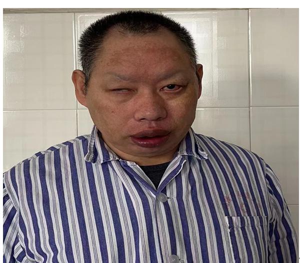 走失者照片 福州福清寻亲：中年男子被救助，右眼...