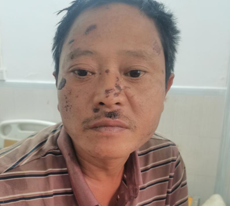 走失者照片 玉林北流寻亲：中年男子被救助，高1...