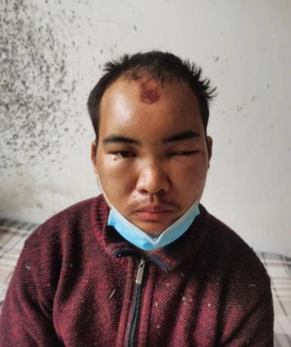 走失者照片 晋中寻亲：青年男子被救助，智力异常...