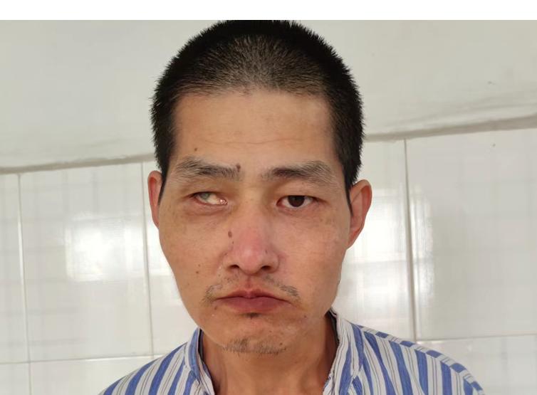 走失者照片 福州福清寻亲：中年男子被救助，高1...