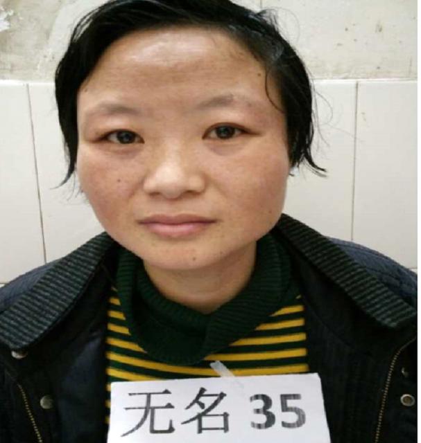 走失者照片 永州寻亲：青年女子被救助，高1米4...