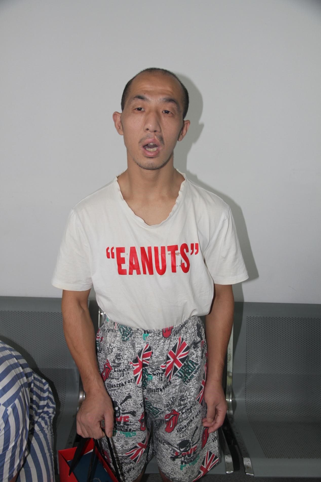 走失者照片 宁波寻亲：青年男子被救助，智力异常