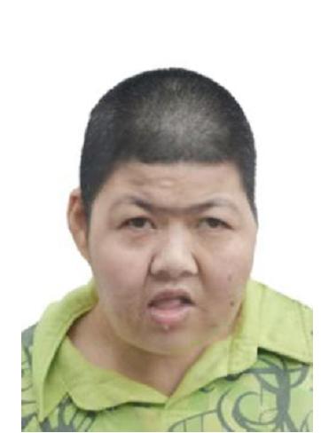 走失者照片 郴州寻亲：青年女子被救助，高1米5...