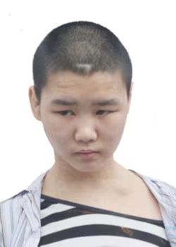 走失者照片 郴州寻亲：青年女子被救助，偏瘦，高...