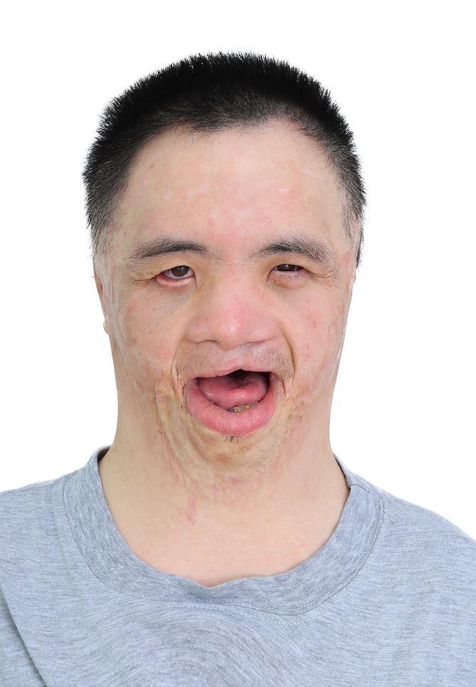 走失者照片 湖南郴州寻亲：青年男子在佛山被救助...