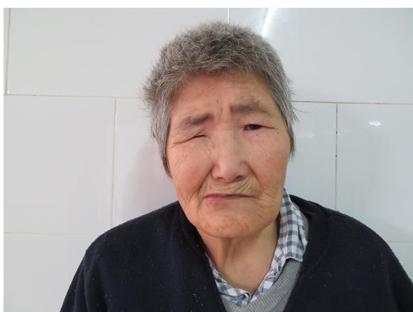 走失者照片 广州寻亲：七旬老太被救助，重60公...