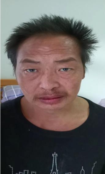 走失者照片 资阳寻亲：五旬男子被救助，智力异常...
