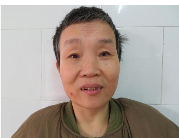 走失者照片 广州寻亲：中年女子被救助多年，穿绿...