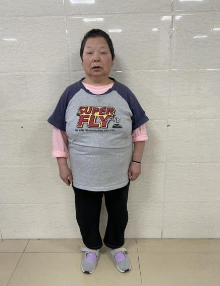 走失者照片 重庆寻亲：五旬女子被救助，患精神分...