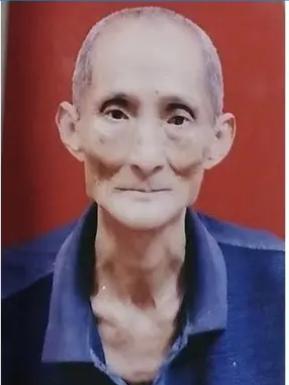 走失者照片 梅州兴宁急寻：七旬老人走失，精神异...